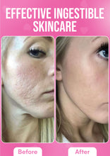 Load image into Gallery viewer, It Girl Skin – Skin Food
